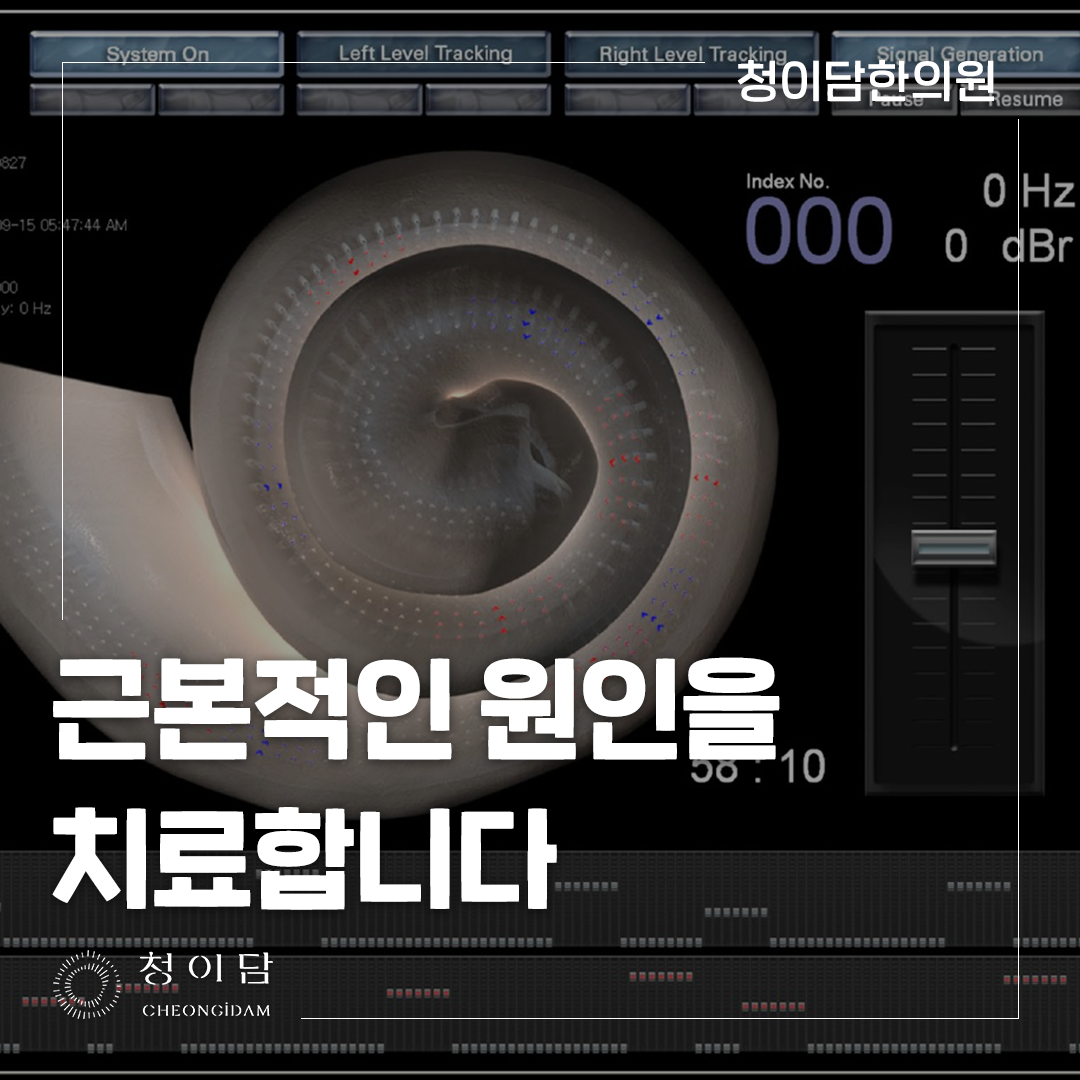 이명 원인, 이명 소리의 종류만으로 판단 하지 않습니다.